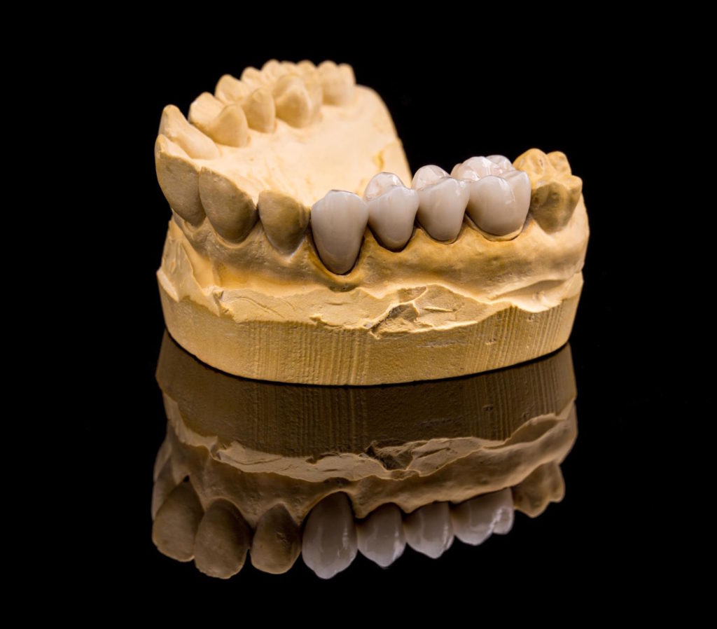 Nowe metody produkcji protez dentystycznych kładą nacisk na perfekcyjność wykonania oraz indywidualizację rozwiązań.