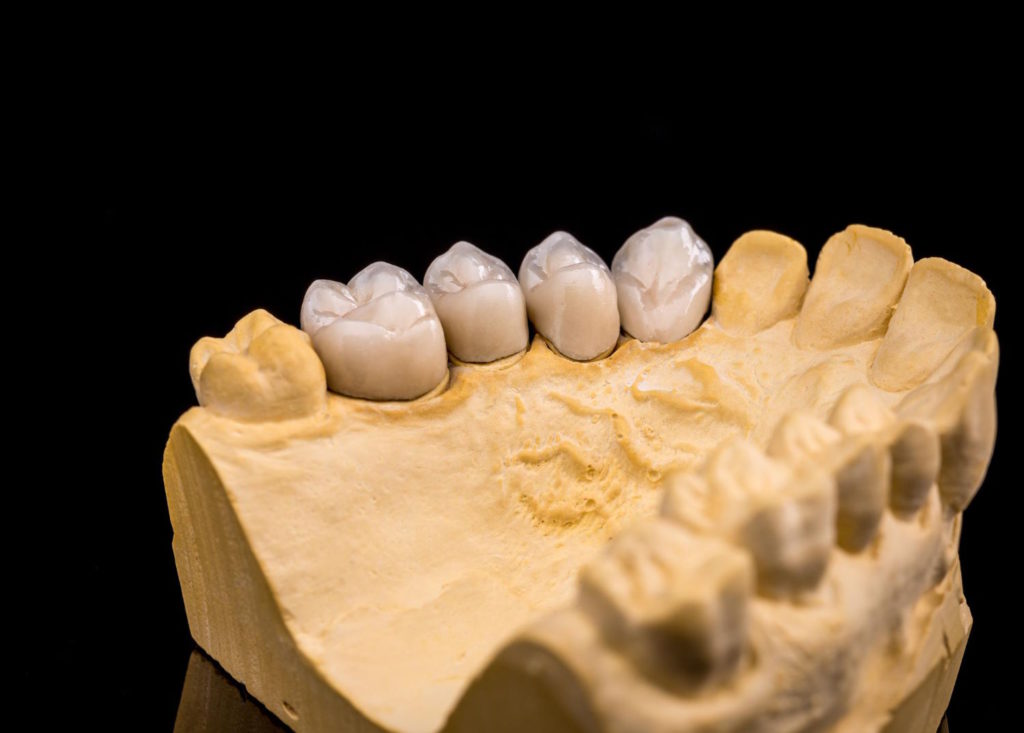 Nowe metody produkcji protez dentystycznych kładą nacisk na perfekcyjność wykonania oraz indywidualizację rozwiązań.